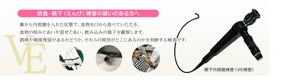VE検査
