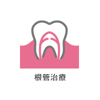 根管治療